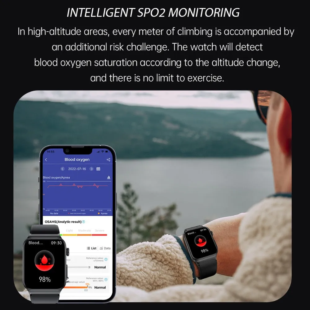 XIAOMI E500 ECG PPG Smart Watch Blood Glucose Electrocardiogram Temperature Blood Oxygen Sleep Monitoring Sports Smart Watch